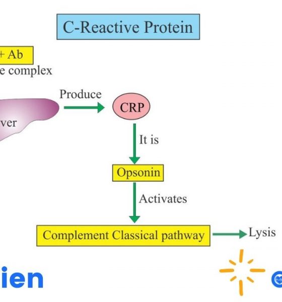 C-Reactive Protein (CRP) Test